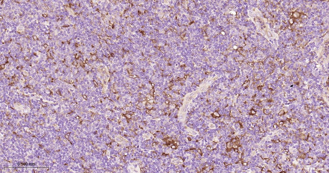 ATG7 Antibody in Immunohistochemistry (Paraffin) (IHC (P))