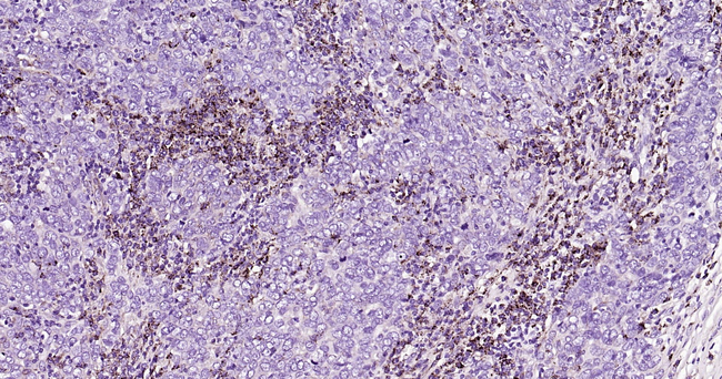 LAMP2 Antibody in Immunohistochemistry (Paraffin) (IHC (P))