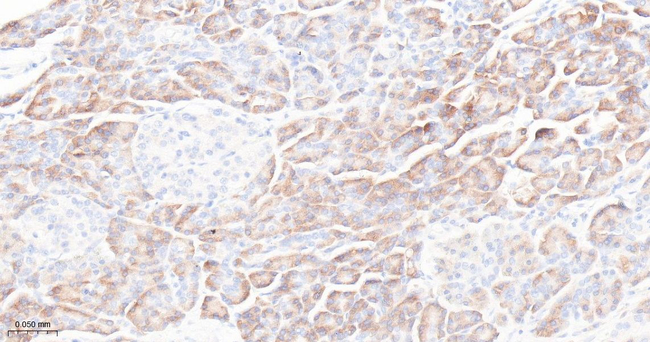 RPS3 Antibody in Immunohistochemistry (Paraffin) (IHC (P))