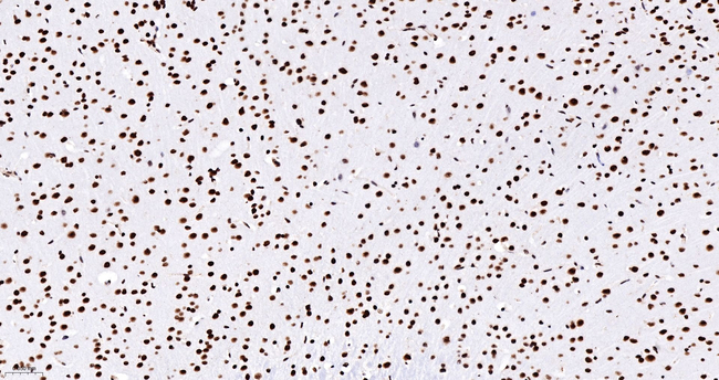 ASH2L Antibody in Immunohistochemistry (Paraffin) (IHC (P))