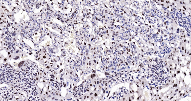 DNMT3A Antibody in Immunohistochemistry (Paraffin) (IHC (P))