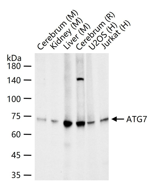 ATG7 Antibody in Western Blot (WB)