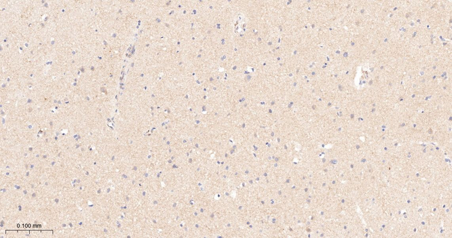 mGluR5 Antibody in Immunohistochemistry (Paraffin) (IHC (P))