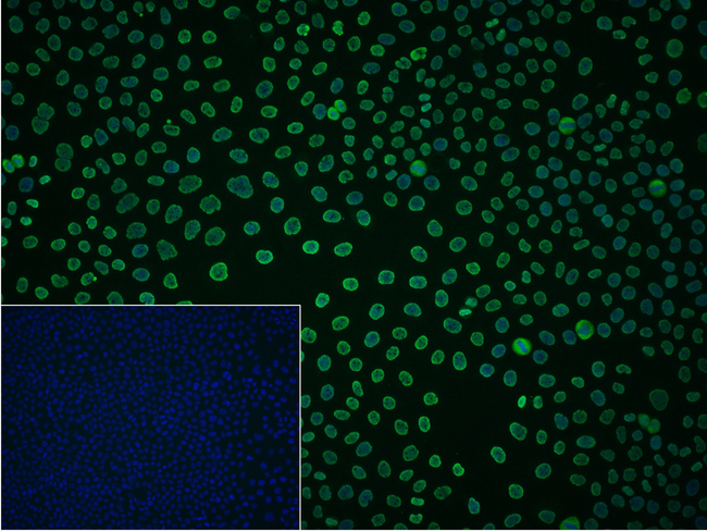 Lamin B Receptor Antibody in Immunocytochemistry (ICC/IF)