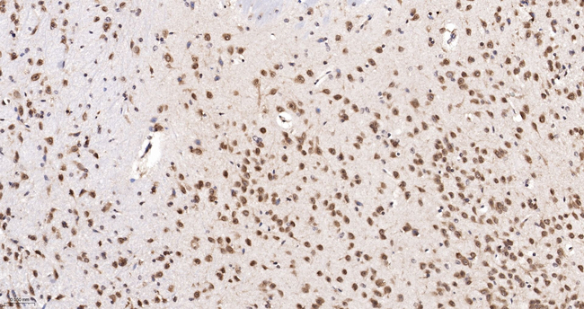 UBC9 Antibody in Immunohistochemistry (Paraffin) (IHC (P))