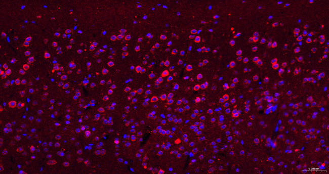 TPH1 Antibody in Immunohistochemistry (Paraffin) (IHC (P))