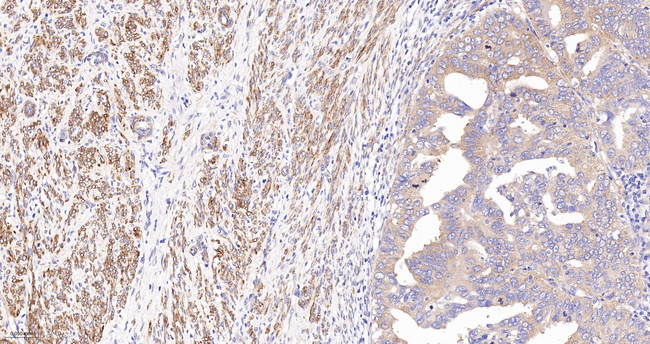 ACACA/ACACB Antibody in Immunohistochemistry (Paraffin) (IHC (P))