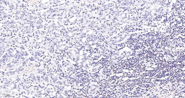 DAXX Antibody in Immunohistochemistry (Paraffin) (IHC (P))