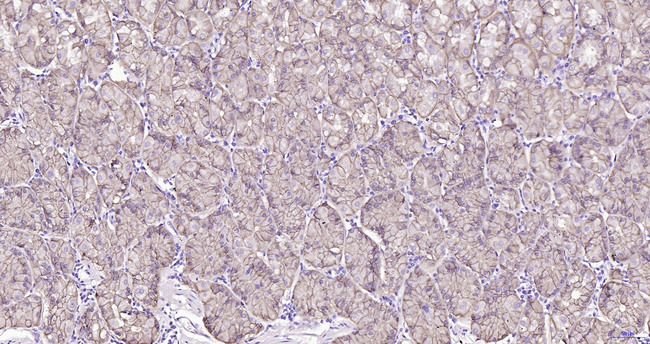 Carbonic Anhydrase IX Antibody in Immunohistochemistry (Paraffin) (IHC (P))
