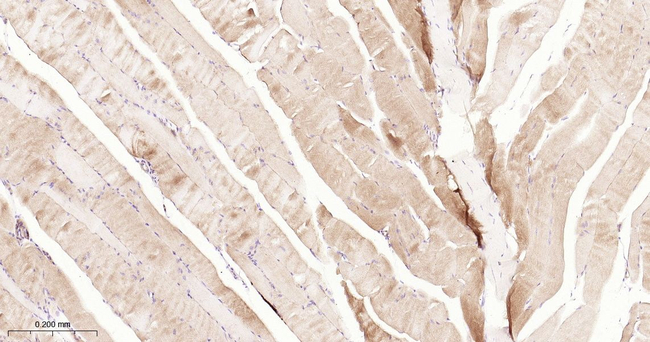Dysferlin Antibody in Immunohistochemistry (Paraffin) (IHC (P))