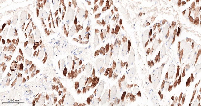 SERCA1 ATPase Antibody in Immunohistochemistry (Paraffin) (IHC (P))