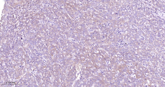 MST2 Antibody in Immunohistochemistry (Paraffin) (IHC (P))