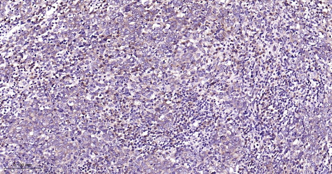 PEBP1 Antibody in Immunohistochemistry (Paraffin) (IHC (P))