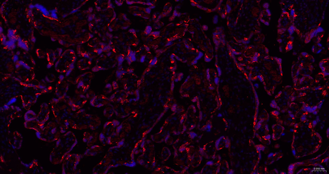 MSI2 Antibody in Immunohistochemistry (Paraffin) (IHC (P))