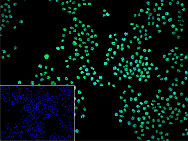 hnRNP K Antibody in Immunocytochemistry (ICC/IF)