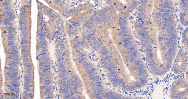 Protein APC Antibody in Immunohistochemistry (Paraffin) (IHC (P))