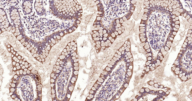 SCF Antibody in Immunohistochemistry (Paraffin) (IHC (P))