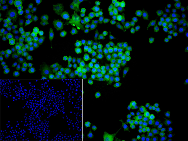Cortactin Antibody in Immunocytochemistry (ICC/IF)