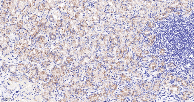 Catenin alpha-1 Antibody in Immunohistochemistry (Paraffin) (IHC (P))