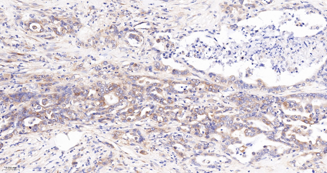 Radixin Antibody in Immunohistochemistry (Paraffin) (IHC (P))