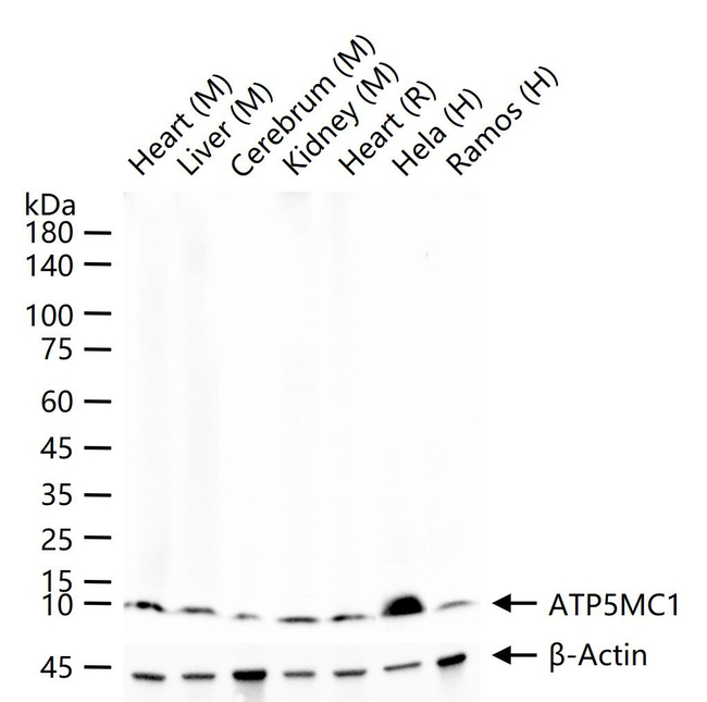 ATP5G1 Antibody in Western Blot (WB)