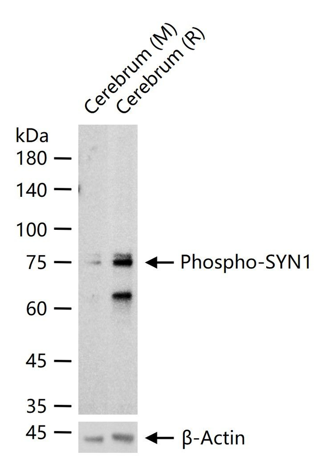 Phospho-Synapsin 1 (Ser9) Antibody in Western Blot (WB)