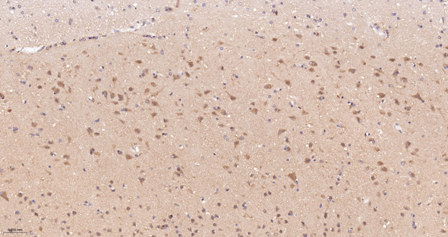 RALBP1 Antibody in Immunohistochemistry (Paraffin) (IHC (P))