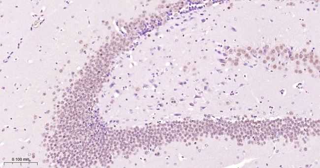 hnRNP C1/C2 Antibody in Immunohistochemistry (Paraffin) (IHC (P))