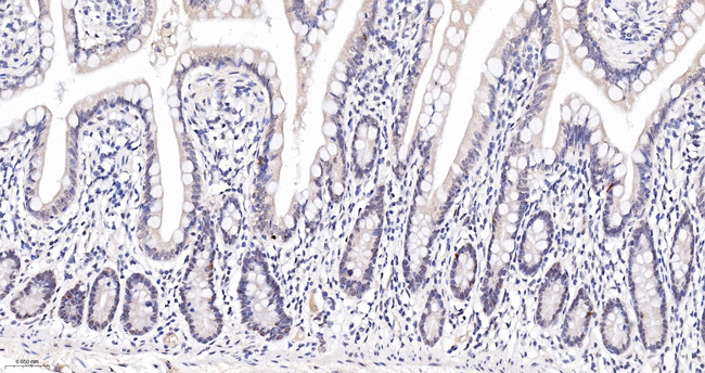 MAD2L1BP Antibody in Immunohistochemistry (Paraffin) (IHC (P))