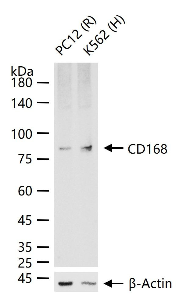 RHAMM Antibody in Western Blot (WB)