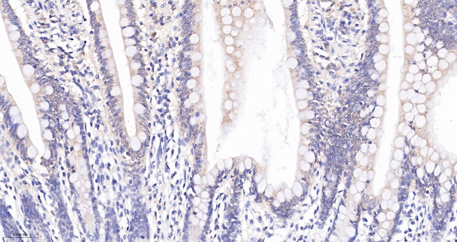 PYCARD Antibody in Immunohistochemistry (Paraffin) (IHC (P))