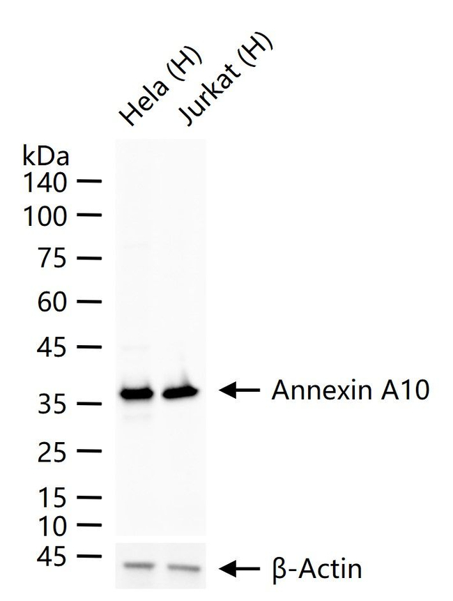 Annexin A10 Antibody in Western Blot (WB)
