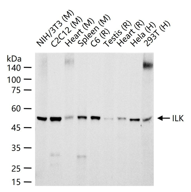 ILK Antibody in Western Blot (WB)