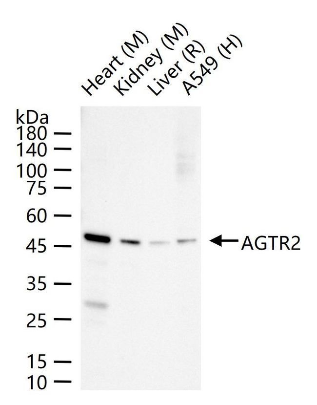 AGTR2 Antibody in Western Blot (WB)