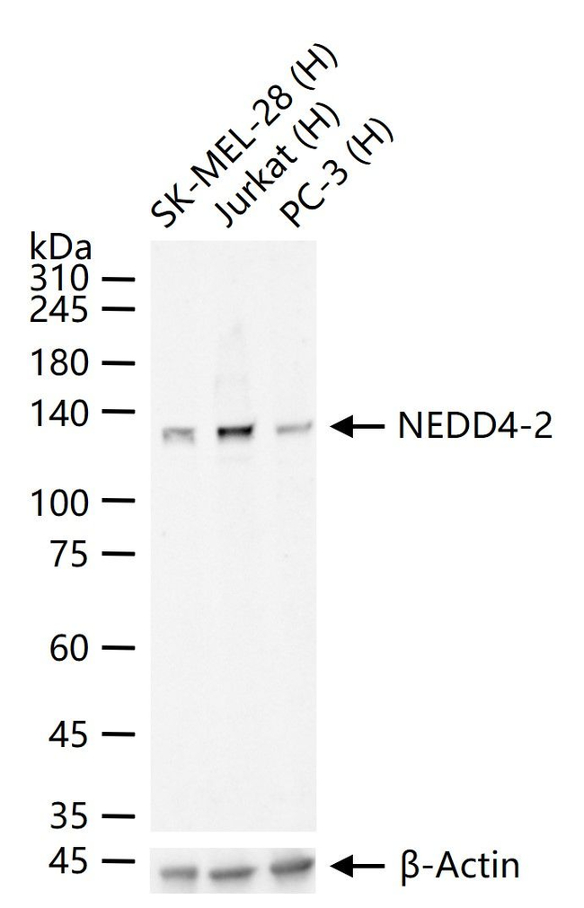 NEDD4L Antibody in Western Blot (WB)
