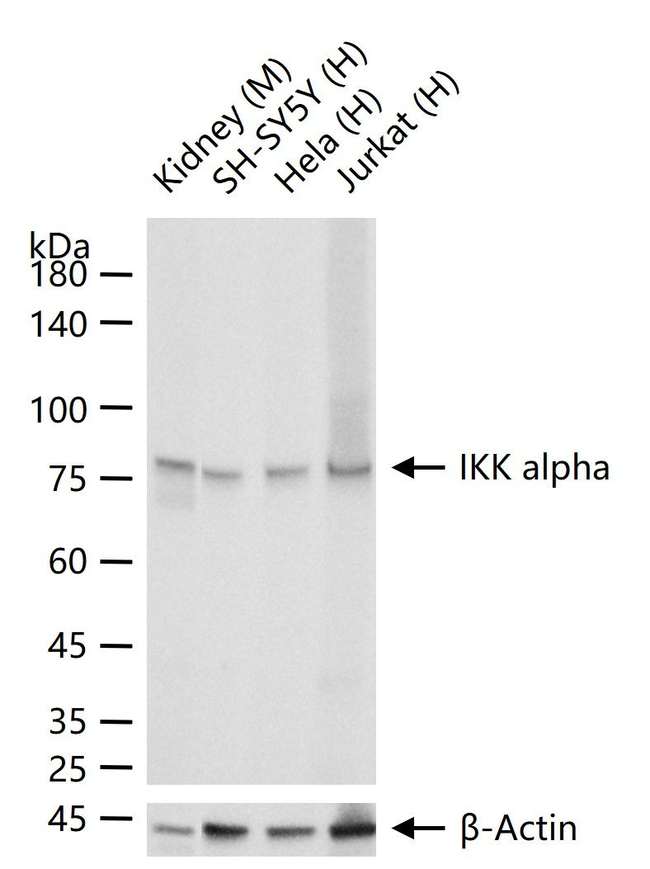 IKK alpha Antibody in Western Blot (WB)