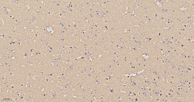 BIN1 Antibody in Immunohistochemistry (Paraffin) (IHC (P))