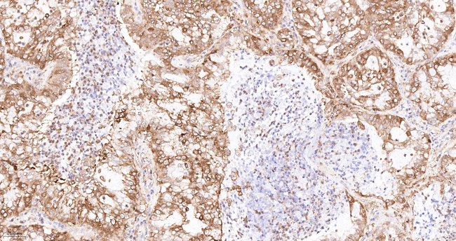 PKM2 Antibody in Immunohistochemistry (Paraffin) (IHC (P))