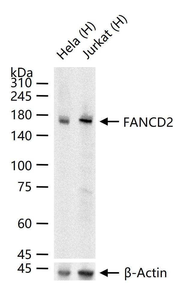 FANCD2 Antibody in Western Blot (WB)