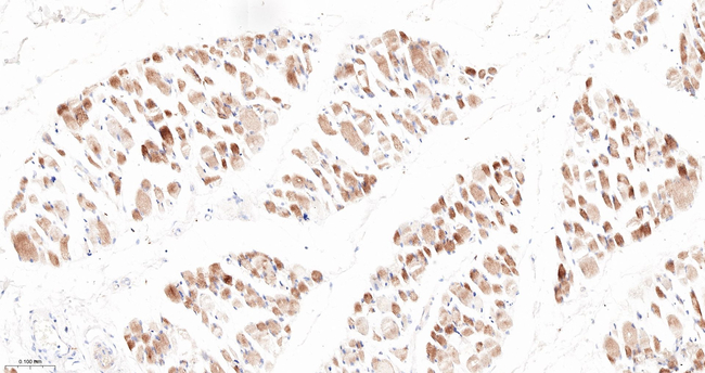 INPP4B Antibody in Immunohistochemistry (Paraffin) (IHC (P))