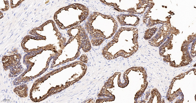 PSA Antibody in Immunohistochemistry (Paraffin) (IHC (P))