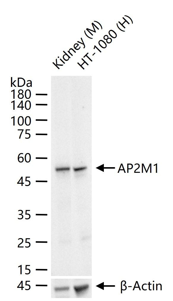 AP2M1 Antibody in Western Blot (WB)
