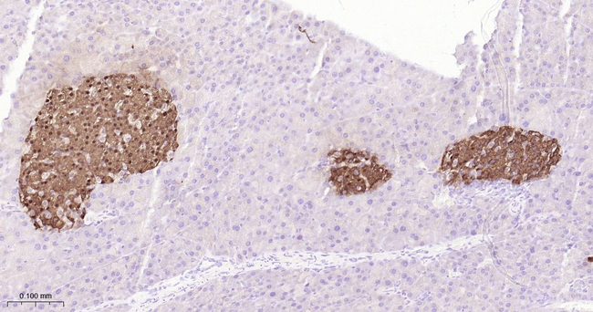PPP1R1A Antibody in Immunohistochemistry (Paraffin) (IHC (P))