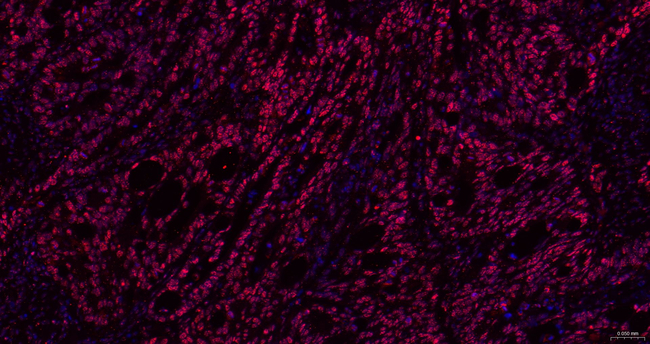 BRG1 Antibody in Immunohistochemistry (Paraffin) (IHC (P))