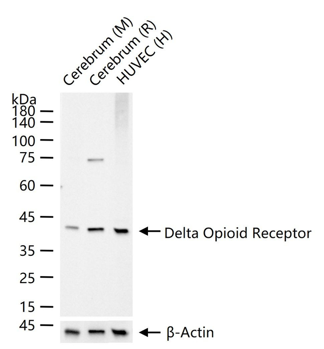 OPRD1 Antibody in Western Blot (WB)