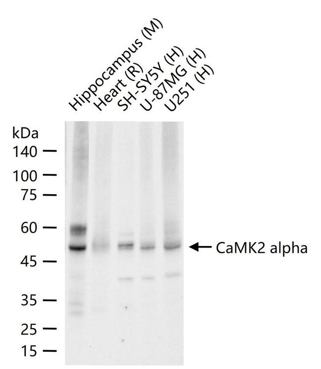 CaMKII alpha Antibody in Western Blot (WB)