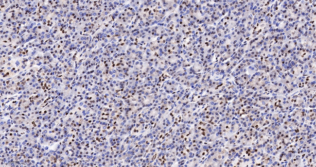 CDC5L Antibody in Immunohistochemistry (Paraffin) (IHC (P))