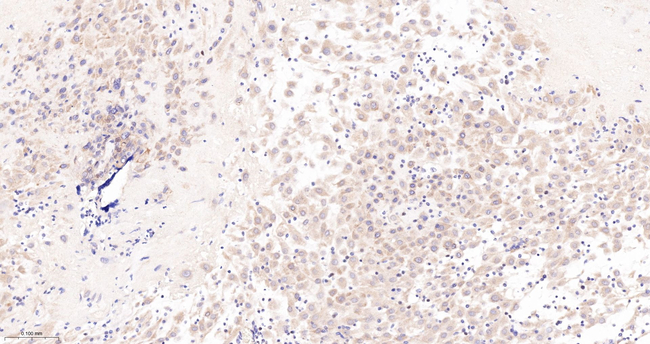 Caspase 2 Antibody in Immunohistochemistry (Paraffin) (IHC (P))