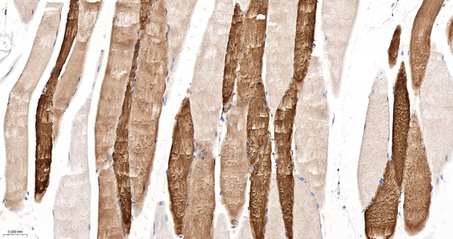 HSP20 Antibody in Immunohistochemistry (Paraffin) (IHC (P))