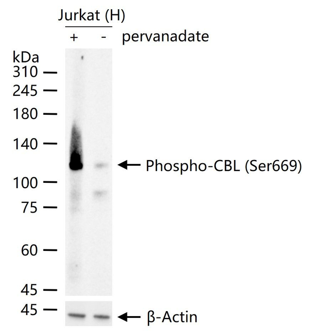 Phospho-c-Cbl (Ser669) Antibody in Western Blot (WB)